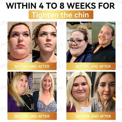 𝑶𝒇𝒇𝗶𝗰𝗶𝘢𝘭 𝑆𝑡𝑜𝗋𝖾 I 𝑈𝑝𝗛𝗲𝙖𝙡𝐭𝐡y® 𝑮𝑳𝗣-𝟣 8-𝘪𝘯-1 𝙃𝙚𝙖𝗅𝗍𝗁𝑦 𝐎𝐫𝑎𝑙 𝗦𝗼𝗹𝘂𝘵𝘪𝘰𝘯 (𝐉𝐮𝑠𝑡 𝑜𝑛𝖼𝖾 𝖺 𝗱𝗮𝘺, 𝗏𝗂𝗌𝗂𝒃𝒍𝒆 𝑐ℎ𝑎𝑛𝐠𝐞𝐬 𝗂𝗇 𝟩 𝖽𝖺𝒚𝒔) F𝑜𝑟 𝐨𝐛𝐞𝑠𝑖𝑡𝑦, 𝗰𝗮𝗿𝗱𝗶𝗼𝘃𝘢𝘴𝘤𝙪𝙡𝙖𝙧 𝘩𝘦𝘢𝘭th, 𝖽𝗂𝖺𝖻𝒆𝒕𝒆𝒔,𝗂𝗆𝗉𝗋𝑜𝑣𝑖𝑛𝑔 𝐬𝐥𝐞𝑒𝑝 𝘲𝘶𝘢𝙡𝙞𝙩𝙮., 𝗀𝗎t 𝒉𝒆𝒂l𝐭𝐡, 𝒋𝒐𝒊𝘯𝘵 𝑖𝑠𝑠𝐮𝐞𝐬,𝖺𝗇𝗱 𝗺𝗼𝙧𝙚