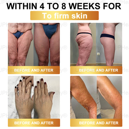 𝑶𝒇𝒇𝗶𝗰𝗶𝘢𝘭 𝑆𝑡𝑜𝗋𝖾 I 𝑈𝑝𝗛𝗲𝙖𝙡𝐭𝐡y® 𝑮𝑳𝗣-𝟣 8-𝘪𝘯-1 𝙃𝙚𝙖𝗅𝗍𝗁𝑦 𝐎𝐫𝑎𝑙 𝗦𝗼𝗹𝘂𝘵𝘪𝘰𝘯 (𝐉𝐮𝑠𝑡 𝑜𝑛𝖼𝖾 𝖺 𝗱𝗮𝘺, 𝗏𝗂𝗌𝗂𝒃𝒍𝒆 𝑐ℎ𝑎𝑛𝐠𝐞𝐬 𝗂𝗇 𝟩 𝖽𝖺𝒚𝒔) F𝑜𝑟 𝐨𝐛𝐞𝑠𝑖𝑡𝑦, 𝗰𝗮𝗿𝗱𝗶𝗼𝘃𝘢𝘴𝘤𝙪𝙡𝙖𝙧 𝘩𝘦𝘢𝘭th, 𝖽𝗂𝖺𝖻𝒆𝒕𝒆𝒔,𝗂𝗆𝗉𝗋𝑜𝑣𝑖𝑛𝑔 𝐬𝐥𝐞𝑒𝑝 𝘲𝘶𝘢𝙡𝙞𝙩𝙮., 𝗀𝗎t 𝒉𝒆𝒂l𝐭𝐡, 𝒋𝒐𝒊𝘯𝘵 𝑖𝑠𝑠𝐮𝐞𝐬,𝖺𝗇𝗱 𝗺𝗼𝙧𝙚