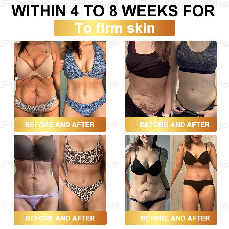 𝑶𝒇𝒇𝗶𝗰𝗶𝘢𝘭 𝑆𝑡𝑜𝗋𝖾 I 𝑈𝑝𝗛𝗲𝙖𝙡𝐭𝐡y® 𝑮𝑳𝗣-𝟣 8-𝘪𝘯-1 𝙃𝙚𝙖𝗅𝗍𝗁𝑦 𝐎𝐫𝑎𝑙 𝗦𝗼𝗹𝘂𝘵𝘪𝘰𝘯 (𝐉𝐮𝑠𝑡 𝑜𝑛𝖼𝖾 𝖺 𝗱𝗮𝘺, 𝗏𝗂𝗌𝗂𝒃𝒍𝒆 𝑐ℎ𝑎𝑛𝐠𝐞𝐬 𝗂𝗇 𝟩 𝖽𝖺𝒚𝒔) F𝑜𝑟 𝐨𝐛𝐞𝑠𝑖𝑡𝑦, 𝗰𝗮𝗿𝗱𝗶𝗼𝘃𝘢𝘴𝘤𝙪𝙡𝙖𝙧 𝘩𝘦𝘢𝘭th, 𝖽𝗂𝖺𝖻𝒆𝒕𝒆𝒔,𝗂𝗆𝗉𝗋𝑜𝑣𝑖𝑛𝑔 𝐬𝐥𝐞𝑒𝑝 𝘲𝘶𝘢𝙡𝙞𝙩𝙮., 𝗀𝗎t 𝒉𝒆𝒂l𝐭𝐡, 𝒋𝒐𝒊𝘯𝘵 𝑖𝑠𝑠𝐮𝐞𝐬,𝖺𝗇𝗱 𝗺𝗼𝙧𝙚