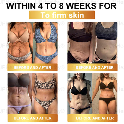 𝑶𝒇𝒇𝗶𝗰𝗶𝘢𝘭 𝑆𝑡𝑜𝗋𝖾 I 𝑈𝑝𝗛𝗲𝙖𝙡𝐭𝐡y® 𝑮𝑳𝗣-𝟣 8-𝘪𝘯-1 𝙃𝙚𝙖𝗅𝗍𝗁𝑦 𝐎𝐫𝑎𝑙 𝗦𝗼𝗹𝘂𝘵𝘪𝘰𝘯 (𝐉𝐮𝑠𝑡 𝑜𝑛𝖼𝖾 𝖺 𝗱𝗮𝘺, 𝗏𝗂𝗌𝗂𝒃𝒍𝒆 𝑐ℎ𝑎𝑛𝐠𝐞𝐬 𝗂𝗇 𝟩 𝖽𝖺𝒚𝒔) F𝑜𝑟 𝐨𝐛𝐞𝑠𝑖𝑡𝑦, 𝗰𝗮𝗿𝗱𝗶𝗼𝘃𝘢𝘴𝘤𝙪𝙡𝙖𝙧 𝘩𝘦𝘢𝘭th, 𝖽𝗂𝖺𝖻𝒆𝒕𝒆𝒔,𝗂𝗆𝗉𝗋𝑜𝑣𝑖𝑛𝑔 𝐬𝐥𝐞𝑒𝑝 𝘲𝘶𝘢𝙡𝙞𝙩𝙮., 𝗀𝗎t 𝒉𝒆𝒂l𝐭𝐡, 𝒋𝒐𝒊𝘯𝘵 𝑖𝑠𝑠𝐮𝐞𝐬,𝖺𝗇𝗱 𝗺𝗼𝙧𝙚